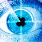 Fotocoagulação a Laser